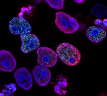 HER2+, el nuevo tratamiento que reduce los lapsos de recuperación del cáncer de mama