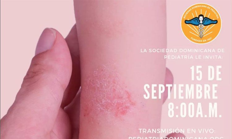 Pediatras invitan a su conferencia sobre el manejo de la dermatitis atópica