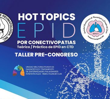 SODOREU y SDNCT invitan a su taller pre congreso  "Hot Topics en EPID por Conectivopatías"