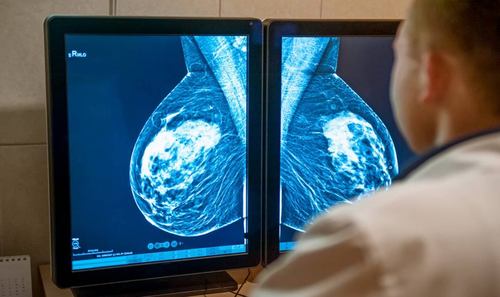 Universidad de Alicante identifica pigmento con capacidad antitumoral contra el cáncer de mama Universidad de Alicante identifica pigmento con capacidad antitumoral contra el cáncer de mama