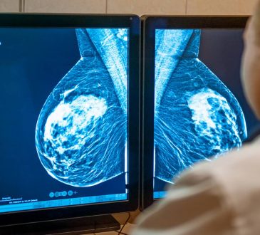 Universidad de Alicante identifica pigmento con capacidad antitumoral contra el cáncer de mama