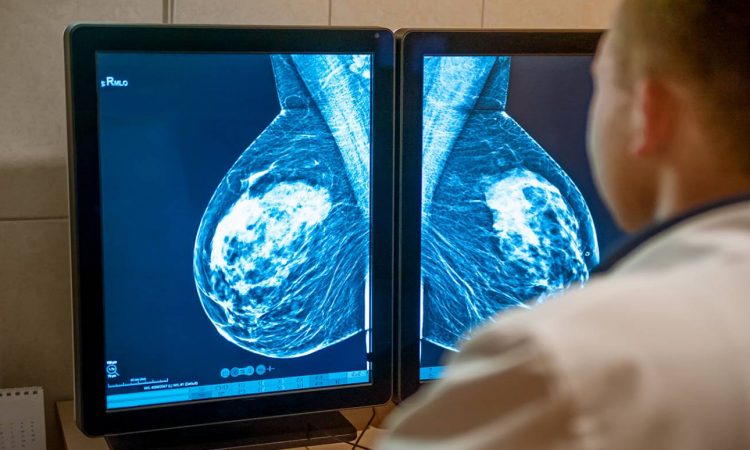 Universidad de Alicante identifica pigmento con capacidad antitumoral contra el cáncer de mama