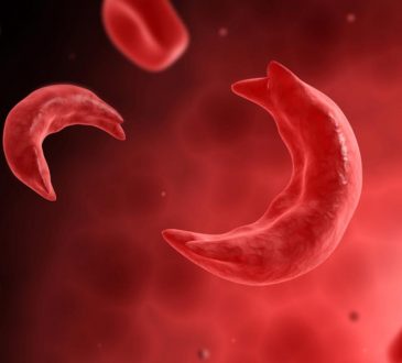 La falcemia, una condición genética que requiere cuidados
