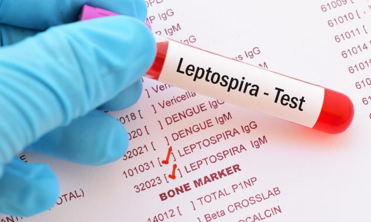Prueba PCR leptospirosis 