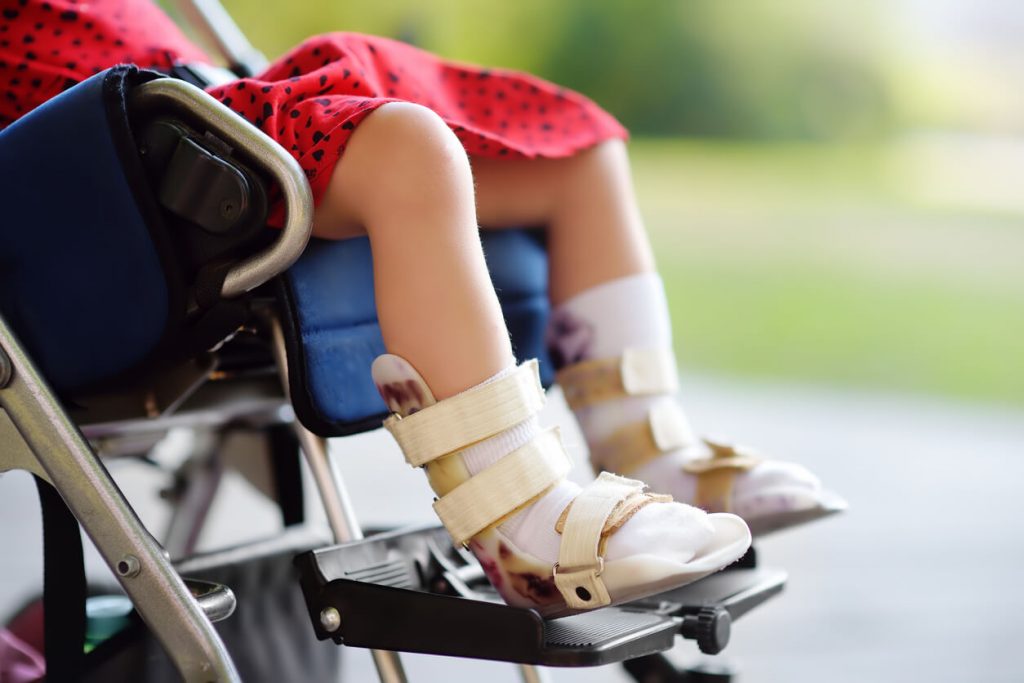 La Atrofia Muscular Espinal: segunda causa genética con mayor mortalidad infantil
