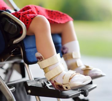 La Atrofia Muscular Espinal: segunda causa genética con mayor mortalidad infantil