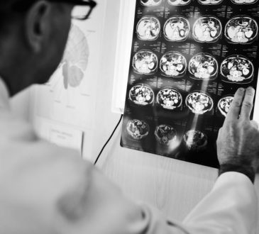 Diagnóstico y tratamiento oportuno contra la epilepsia evitaría sufrir convulsiones
