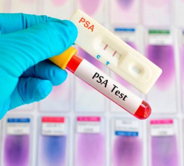 Urólogos y Sanar una Nación invitan operativo preventivo del cáncer de próstata
