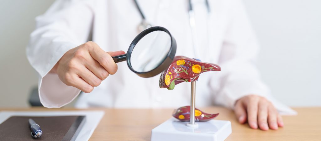 Expertos prevén aumento de la enfermedad hepática metabólica