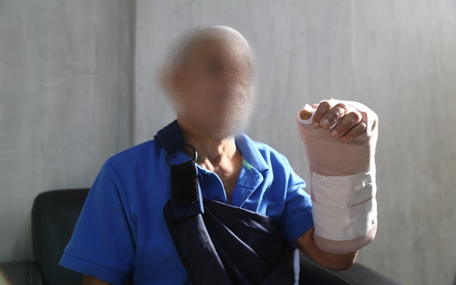 Hospital Gautier destaca evolución de paciente tras reconstrucción de mano
