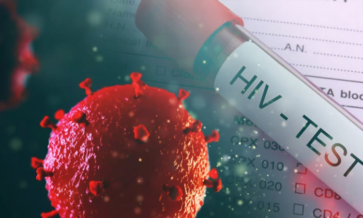 Registran 3,600 casos de VIH cada año en República Dominicana