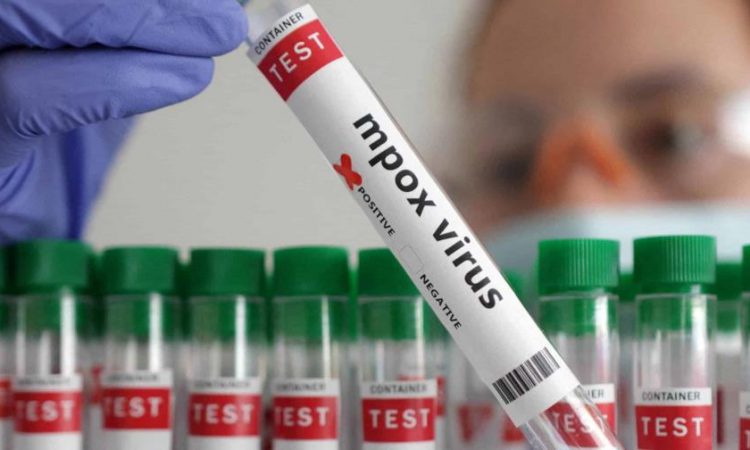 Salud Pública confirma que desde abril no se registran casos de viruela símica en República Dominicana