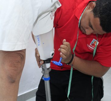 Donan prótesis femorales a 75 personas amputadas, transformando vidas y comunidades en RD