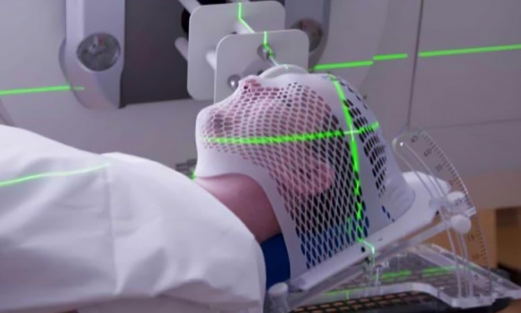 HOMS realiza radiocirugías estereotácticas con tecnología avanzada para pacientes del Cibao