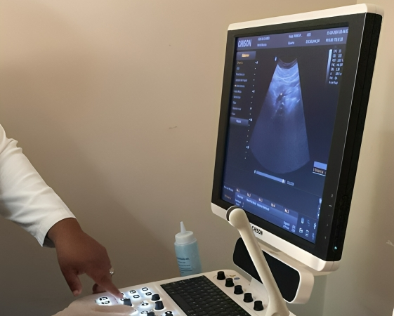 Hospital Jamao al Norte fortalece servicios con nuevo sonógrafo de última tecnología