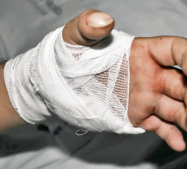 Hospital Salvador B. Gautier realiza con éxito nueve reimplantes de manos en lo que va de año