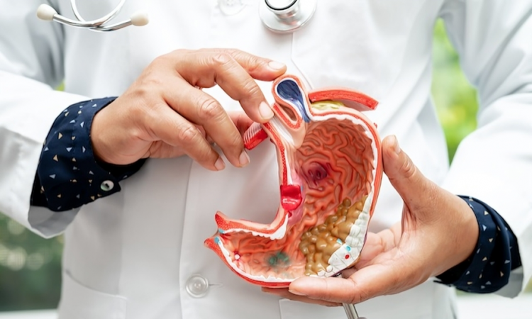 El cáncer de estómago se conecta con los nervios sensoriales para favorecer su crecimiento, según estudio en Nature