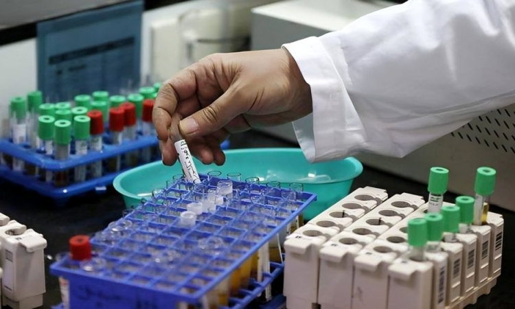 Nuevo test de sangre mejora detección precoz de micrometástasis en cáncer de colon y podría anticipar recaídas