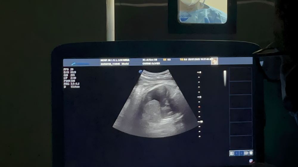 Hospital San Lorenzo de Los Mina realiza primera cirugía fetal y corrección de hernia diafragmática en red pública Hospital San Lorenzo de Los Mina realiza primera cirugía fetal y corrección de hernia diafragmática en red pública