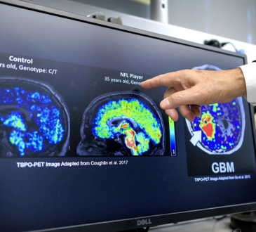 Científicos latinos descubren biomarcador que podría detectar Alzheimer décadas antes de los síntomas