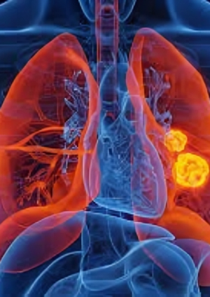 Científicos eliminan mutación clave del cáncer de pulmón con nueva herramienta genética