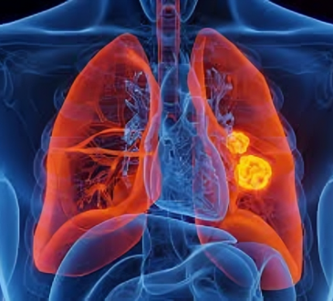 Científicos eliminan mutación clave del cáncer de pulmón con nueva herramienta genética