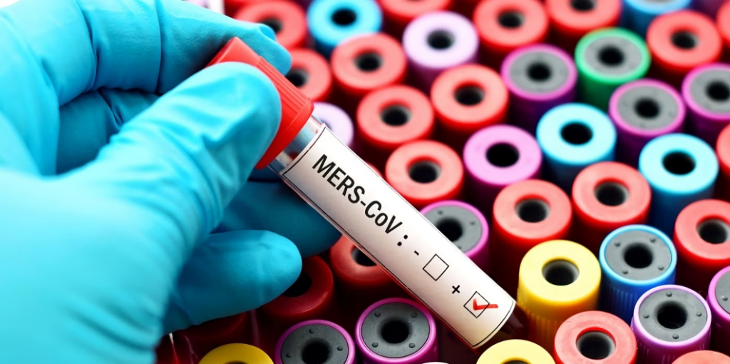 OMS llama a reforzar vigilancia y control en hospitales tras nuevos casos globales de MERS-CoV en 2025