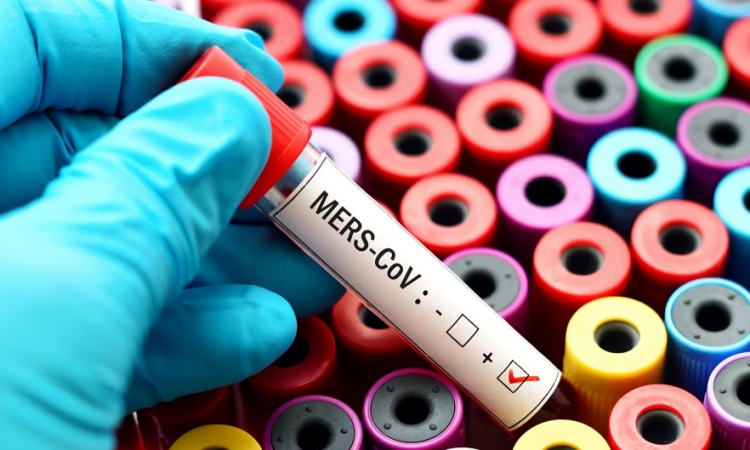 OMS llama a reforzar vigilancia y control en hospitales tras nuevos casos globales de MERS-CoV en 2025