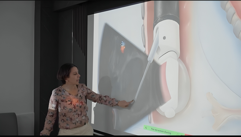 Introducen en RD tecnología para diagnóstico certero de cáncer de pulmón