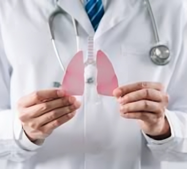 MSK advierte sobre aumento de Cáncer de Pulmón en adultos jóvenes No Fumadores