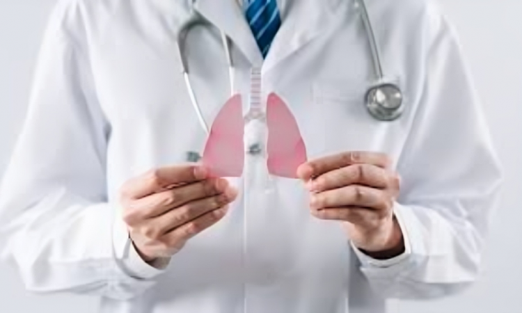 MSK advierte sobre aumento de Cáncer de Pulmón en adultos jóvenes No Fumadores