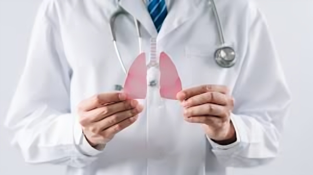 MSK advierte sobre aumento de Cáncer de Pulmón en adultos jóvenes No Fumadores