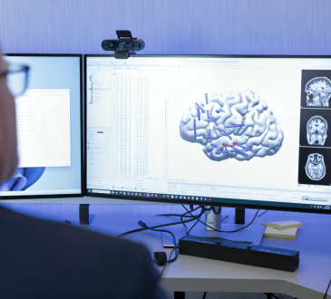 Mayo Clinic desarrolla implante cerebral y Smartwatch con IA para predecir y monitorear crisis epilépticas en tiempo real