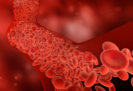 Cleveland Clinic recomienda análisis de colesterol cada cinco años a partir de los 20 años para prevenir infartos y ACV