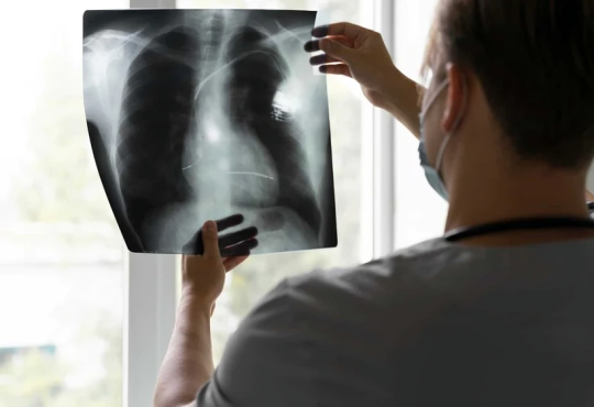 Estudio de Mayo Clinic revela que broncoscopia robótica mejora diagnóstico temprano del cáncer de pulmón con menor invasión Estudio de Mayo Clinic revela que broncoscopia robótica mejora diagnóstico temprano del cáncer de pulmón con menor invasión