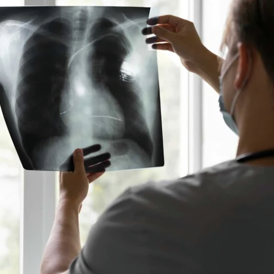 Estudio de Mayo Clinic revela que broncoscopia robótica mejora diagnóstico temprano del cáncer de pulmón con menor invasión