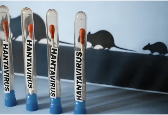 OMS asegura que brote de hantavirus no se convertirá en gran epidemia mundial y pide evitar comparaciones con covid-19 OMS asegura que brote de hantavirus no se convertirá en gran epidemia mundial y pide evitar comparaciones con covid-19