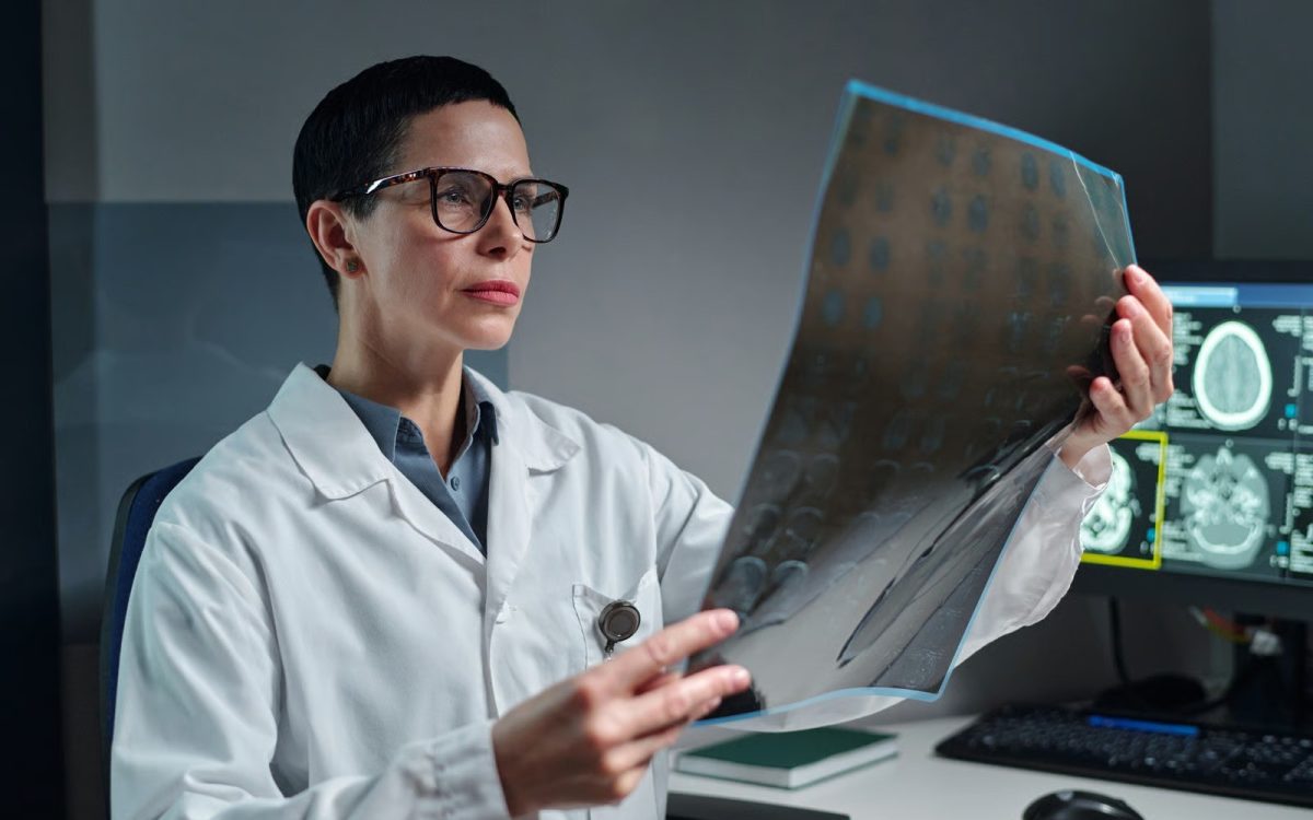 Los tumores cerebrales benignos también pueden afectar funciones vitales, advierte especialista de Cleveland Clinic