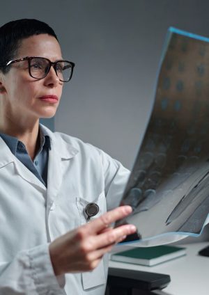 Los tumores cerebrales benignos también pueden afectar funciones vitales, advierte especialista de Cleveland Clinic