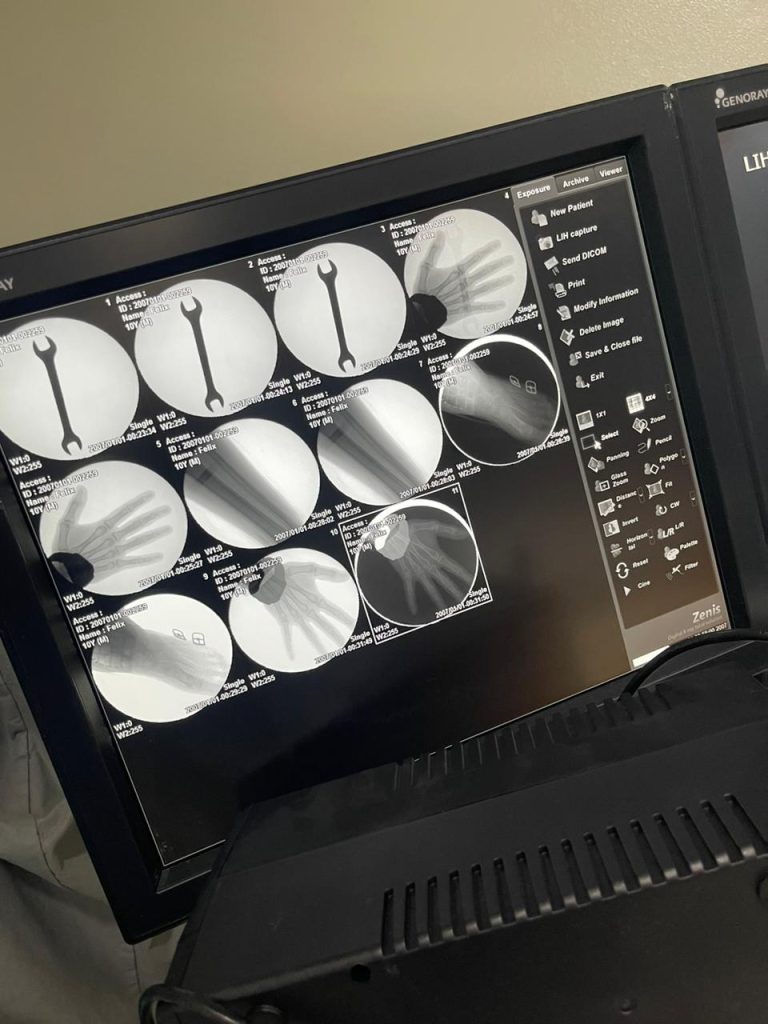 Instituto de Cirugía Especializada incorpora tecnología de vanguardia para procedimientos quirúrgicos de alta precisión