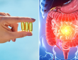 La vitamina D podría ayudar a regular la respuesta inmunitaria en personas con enfermedad inflamatoria intestinal 