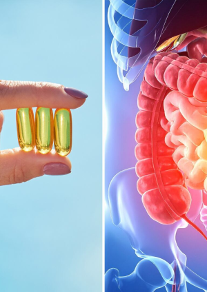 La vitamina D podría ayudar a regular la respuesta inmunitaria en personas con enfermedad inflamatoria intestinal 