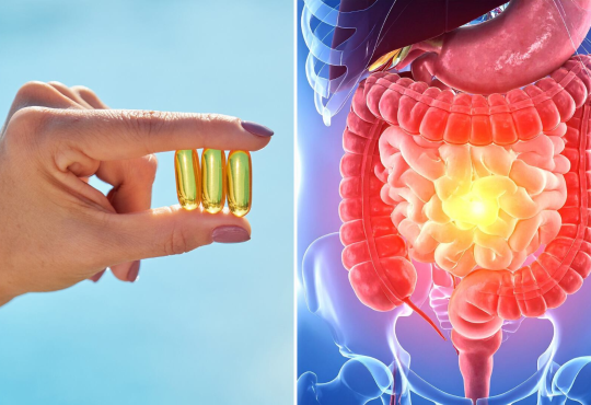 La vitamina D podría ayudar a regular la respuesta inmunitaria en personas con enfermedad inflamatoria intestinal La vitamina D podría ayudar a regular la respuesta inmunitaria en personas con enfermedad inflamatoria intestinal