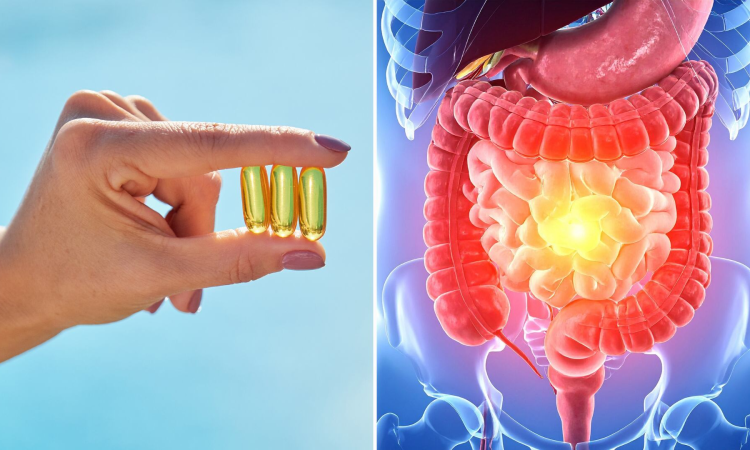 La vitamina D podría ayudar a regular la respuesta inmunitaria en personas con enfermedad inflamatoria intestinal La vitamina D podría ayudar a regular la respuesta inmunitaria en personas con enfermedad inflamatoria intestinal