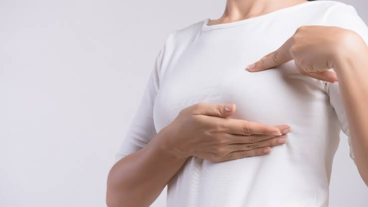El cáncer de mama inflamatorio puede avanzar rápidamente y a menudo no presenta un bulto como señal de alerta